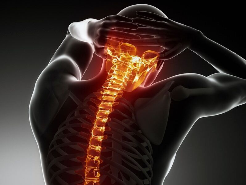 Osteokondroz semptomları