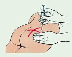 Osteokondroz tedavisi için enjeksiyon